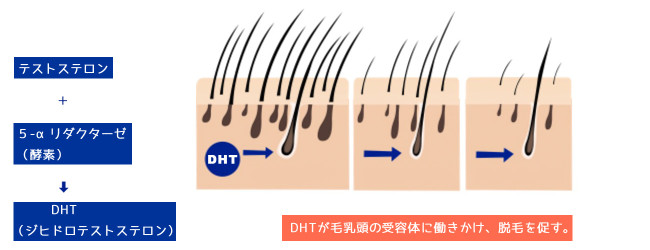 DHTが抜け毛を促す