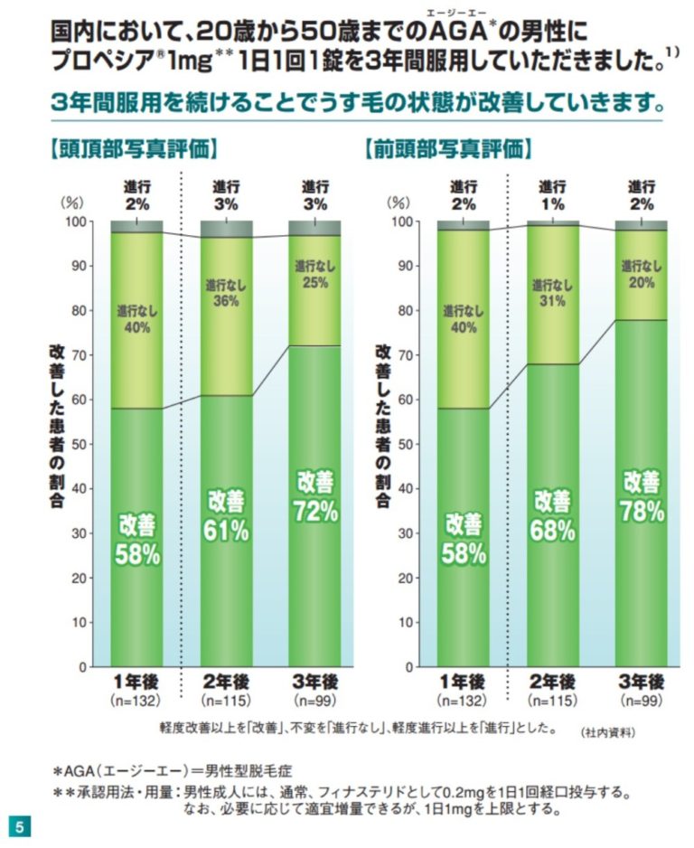 プロペシア効果