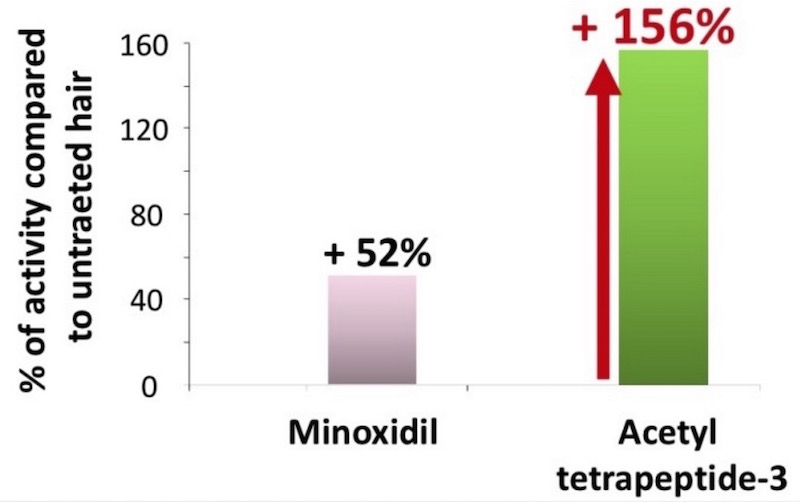 asetiru3