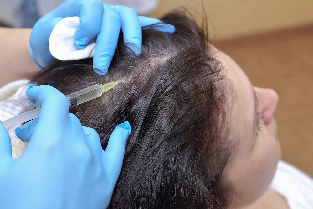 Anti hair loss injection in clinic in clinic